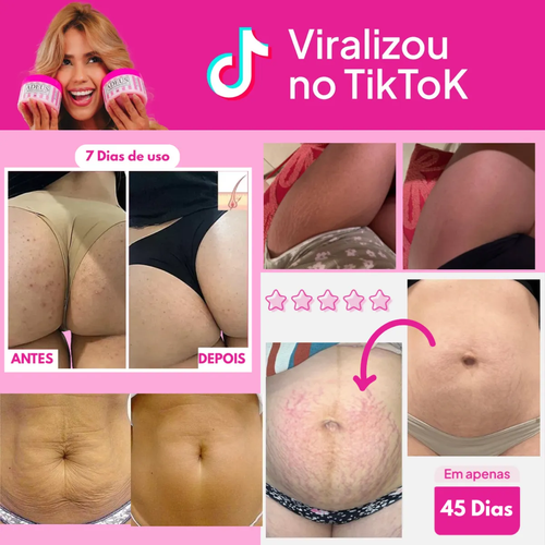 Adeus para Celulitis y Estrías 300ml
